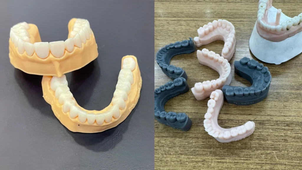 Montagem de guias cirúrgicos realizados pela Stadler 3D